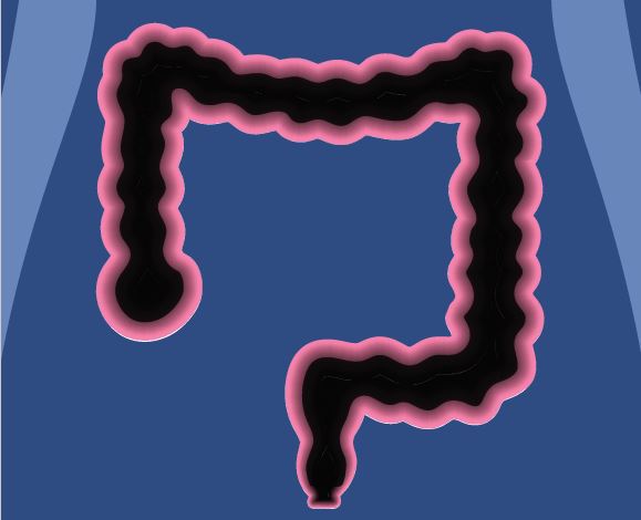 cancer_colorectal_ssaquebec